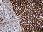 SERBP1 Antibody in Immunohistochemistry (Paraffin) (IHC (P))