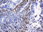 HOXD10 Antibody in Immunohistochemistry (Paraffin) (IHC (P))