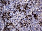 MAGEA3 Antibody in Immunohistochemistry (Paraffin) (IHC (P))