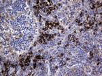 MAGEA3 Antibody in Immunohistochemistry (Paraffin) (IHC (P))