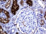 MAGEA3 Antibody in Immunohistochemistry (Paraffin) (IHC (P))