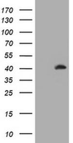 MAGEA3 Antibody in Western Blot (WB)