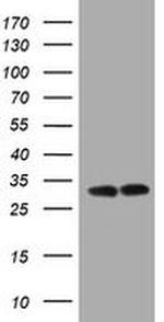 ATP Synthase gamma Antibody in Western Blot (WB)