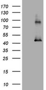 MAGEA3 Antibody in Western Blot (WB)