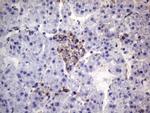 VEGFC Antibody in Immunohistochemistry (Paraffin) (IHC (P))