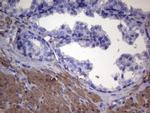 VEGFC Antibody in Immunohistochemistry (Paraffin) (IHC (P))