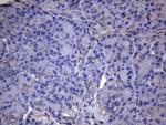 VEGFC Antibody in Immunohistochemistry (Paraffin) (IHC (P))