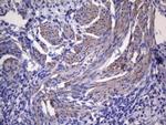 VEGFC Antibody in Immunohistochemistry (Paraffin) (IHC (P))