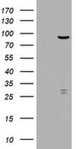 RRM1 Antibody in Western Blot (WB)