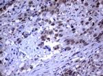 RASGRP3 Antibody in Immunohistochemistry (Paraffin) (IHC (P))