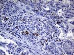 POLI Antibody in Immunohistochemistry (Paraffin) (IHC (P))