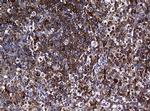 RASGRP3 Antibody in Immunohistochemistry (Paraffin) (IHC (P))