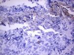 PIK3C2A Antibody in Immunohistochemistry (Paraffin) (IHC (P))