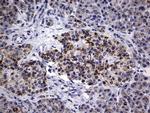 PIK3CD Antibody in Immunohistochemistry (Paraffin) (IHC (P))