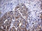 PIK3CD Antibody in Immunohistochemistry (Paraffin) (IHC (P))