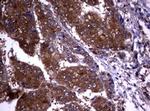 VSNL1 Antibody in Immunohistochemistry (Paraffin) (IHC (P))