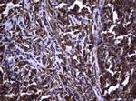 VSNL1 Antibody in Immunohistochemistry (Paraffin) (IHC (P))