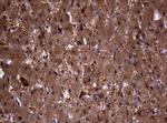 VSNL1 Antibody in Immunohistochemistry (Paraffin) (IHC (P))