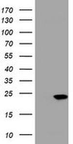 VSNL1 Antibody in Western Blot (WB)