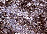 PIK3CD Antibody in Immunohistochemistry (Paraffin) (IHC (P))