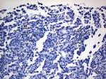 ZEB2 Antibody in Immunohistochemistry (Paraffin) (IHC (P))