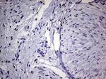 ZEB2 Antibody in Immunohistochemistry (Paraffin) (IHC (P))