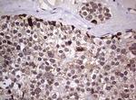 AFAP Antibody in Immunohistochemistry (Paraffin) (IHC (P))