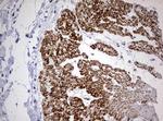 AFAP Antibody in Immunohistochemistry (Paraffin) (IHC (P))