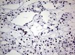 AFAP Antibody in Immunohistochemistry (Paraffin) (IHC (P))