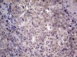 AFAP Antibody in Immunohistochemistry (Paraffin) (IHC (P))