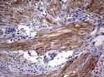 AFAP Antibody in Immunohistochemistry (Paraffin) (IHC (P))