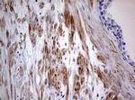 AFAP Antibody in Immunohistochemistry (Paraffin) (IHC (P))