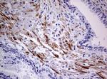 AFAP Antibody in Immunohistochemistry (Paraffin) (IHC (P))