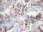 NDUFS2 Antibody in Immunohistochemistry (Paraffin) (IHC (P))