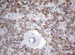 NDUFS2 Antibody in Immunohistochemistry (Paraffin) (IHC (P))