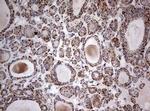 NDUFS2 Antibody in Immunohistochemistry (Paraffin) (IHC (P))