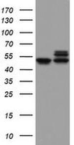 NDUFS2 Antibody in Western Blot (WB)