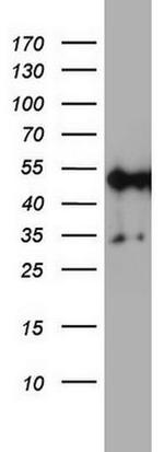 NDUFS2 Antibody in Western Blot (WB)