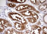 HMBS Antibody in Immunohistochemistry (Paraffin) (IHC (P))