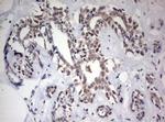 FEN1 Antibody in Immunohistochemistry (Paraffin) (IHC (P))