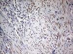 FEN1 Antibody in Immunohistochemistry (Paraffin) (IHC (P))