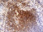 OAS2 Antibody in Immunohistochemistry (Paraffin) (IHC (P))