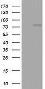 OAS2 Antibody in Western Blot (WB)