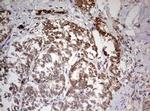 TRIM24 Antibody in Immunohistochemistry (Paraffin) (IHC (P))