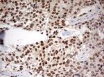 TRIM24 Antibody in Immunohistochemistry (Paraffin) (IHC (P))