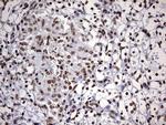 DDX56 Antibody in Immunohistochemistry (Paraffin) (IHC (P))