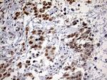 DDX56 Antibody in Immunohistochemistry (Paraffin) (IHC (P))