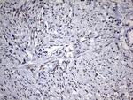 DDX56 Antibody in Immunohistochemistry (Paraffin) (IHC (P))