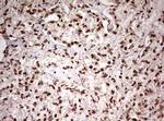 FBXW7 Antibody in Immunohistochemistry (Paraffin) (IHC (P))