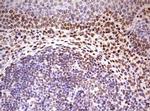 FBXW7 Antibody in Immunohistochemistry (Paraffin) (IHC (P))